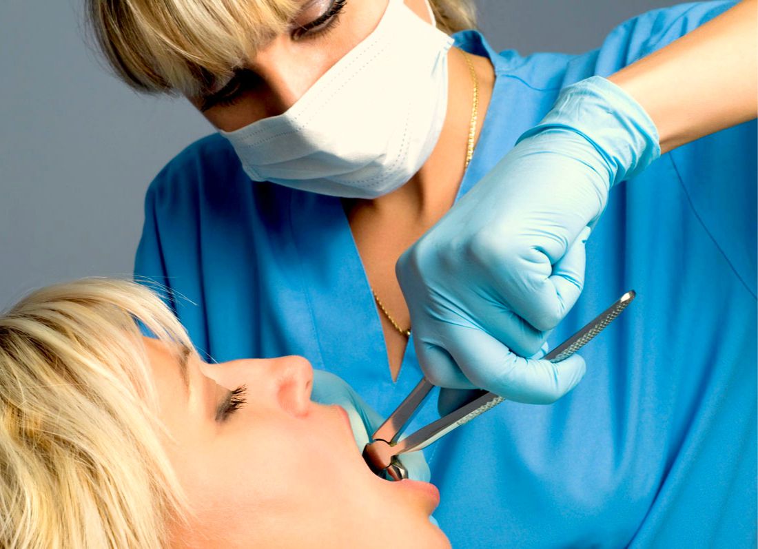 Что нужно знать про процедуру удаления зуба?