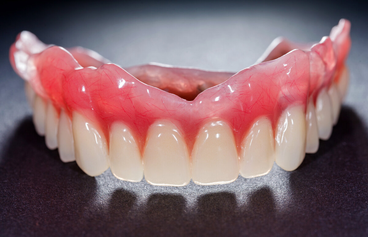Протезирование зубов: красота, комфорт и долговечность